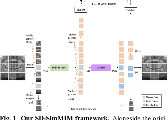 Figure 1 for Enhanced Masked Image Modeling for Analysis of Dental Panoramic Radiographs