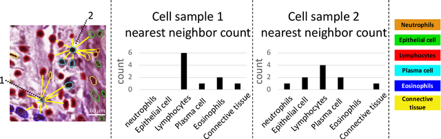 Figure 3 for Cell Spatial Analysis in Crohn's Disease: Unveiling Local Cell Arrangement Pattern with Graph-based Signatures