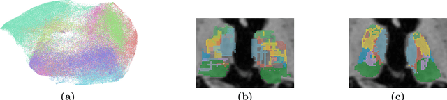 Figure 1 for Segmenting thalamic nuclei from manifold projections of multi-contrast MRI
