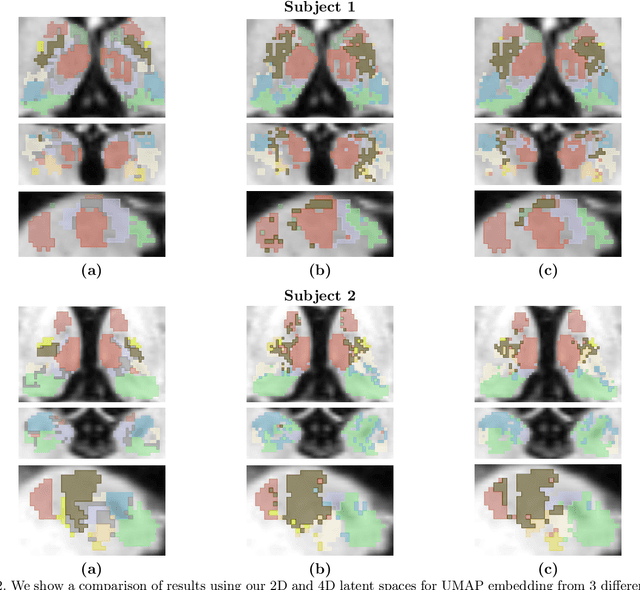 Figure 4 for Segmenting thalamic nuclei from manifold projections of multi-contrast MRI