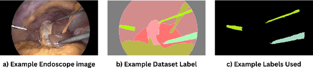 Figure 3 for Exploring Optical Flow Inclusion into nnU-Net Framework for Surgical Instrument Segmentation