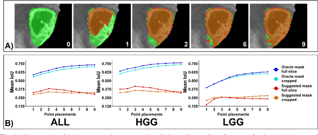 Figure 3 for The Segment Anything foundation model achieves favorable brain tumor autosegmentation accuracy on MRI to support radiotherapy treatment planning