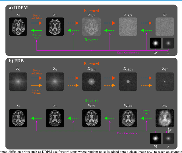 Figure 1 for Learning Fourier-Constrained Diffusion Bridges for MRI Reconstruction