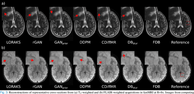 Figure 3 for Learning Fourier-Constrained Diffusion Bridges for MRI Reconstruction