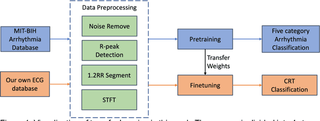 Figure 1 for A new method using deep transfer learning on ECG to predict the response to cardiac resynchronization therapy