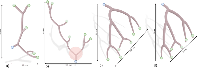 Figure 1 for A Zero-Shot Reinforcement Learning Strategy for Autonomous Guidewire Navigation