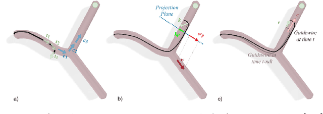 Figure 2 for A Zero-Shot Reinforcement Learning Strategy for Autonomous Guidewire Navigation