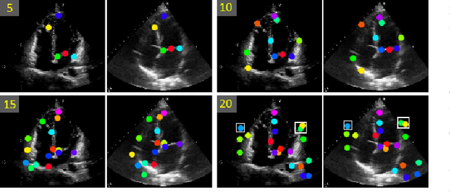 Figure 3 for OnUVS: Online Feature Decoupling Framework for High-Fidelity Ultrasound Video Synthesis