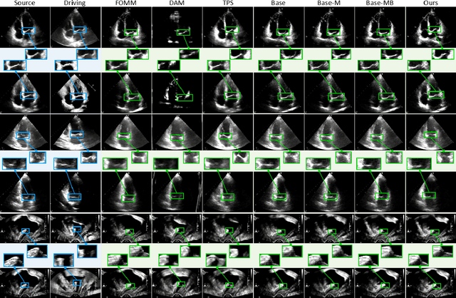 Figure 1 for OnUVS: Online Feature Decoupling Framework for High-Fidelity Ultrasound Video Synthesis