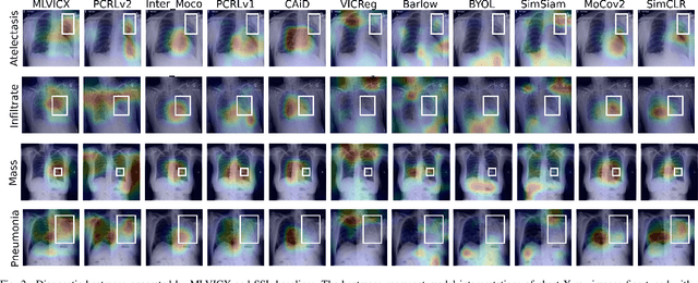 Figure 2 for MLVICX: Multi-Level Variance-Covariance Exploration for Chest X-ray Self-Supervised Representation Learning