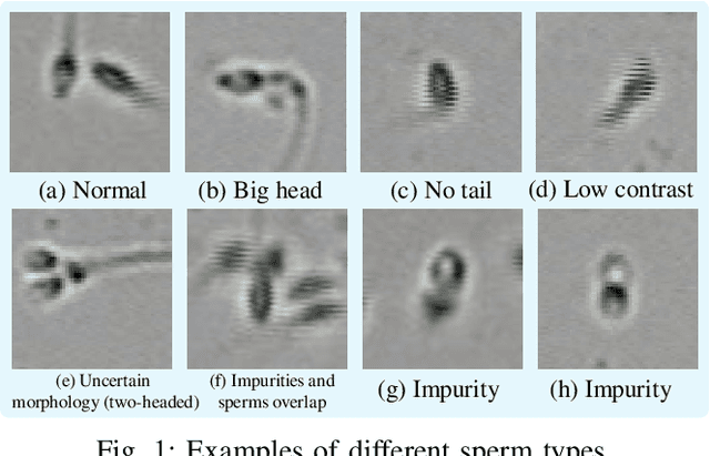 Figure 1 for ACTIVE: A Deep Model for Sperm and Impurity Detection in Microscopic Videos
