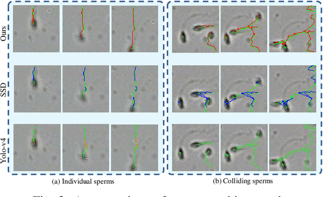 Figure 4 for ACTIVE: A Deep Model for Sperm and Impurity Detection in Microscopic Videos