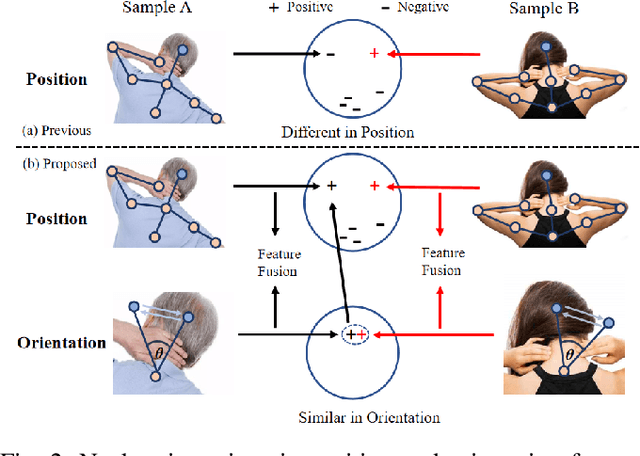 Figure 2 for Position and Orientation-Aware One-Shot Learning for Medical Action Recognition from Signal Data