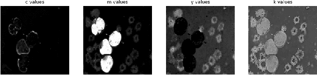 Figure 1 for A Fully Unsupervised Instance Segmentation Technique for White Blood Cell Images