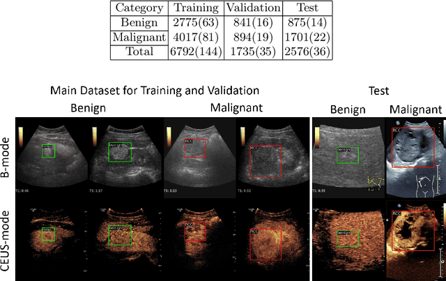 Figure 2 for MUVF-YOLOX: A Multi-modal Ultrasound Video Fusion Network for Renal Tumor Diagnosis