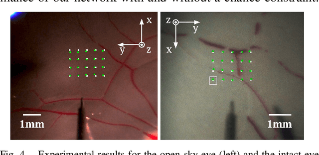 Figure 4 for Autonomous Needle Navigation in Retinal Microsurgery: Evaluation in ex vivo Porcine Eyes