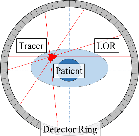 Figure 1 for Improving the Timing Resolution of Positron Emission Tomography Detectors using Boosted Learning -- A Residual Physics Approach