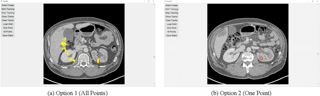 Figure 2 for GazeSAM: What You See is What You Segment