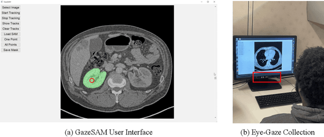 Figure 3 for GazeSAM: What You See is What You Segment