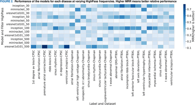 Figure 3 for Exploring Best Practices for ECG Signal Processing in Machine Learning