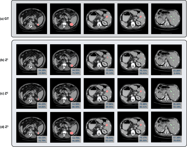 Figure 2 for 3D TransUNet: Advancing Medical Image Segmentation through Vision Transformers