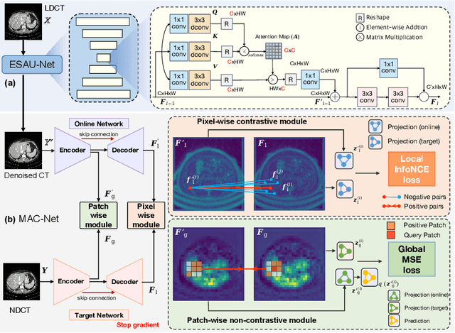 Figure 1 for ASCON: Anatomy-aware Supervised Contrastive Learning Framework for Low-dose CT Denoising