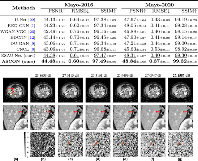 Figure 2 for ASCON: Anatomy-aware Supervised Contrastive Learning Framework for Low-dose CT Denoising