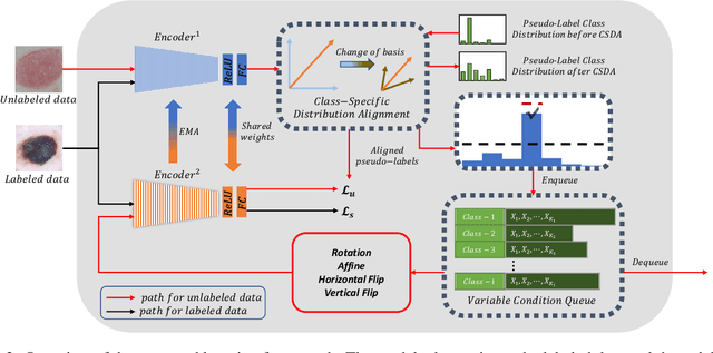 Figure 3 for Class-Specific Distribution Alignment for Semi-Supervised Medical Image Classification