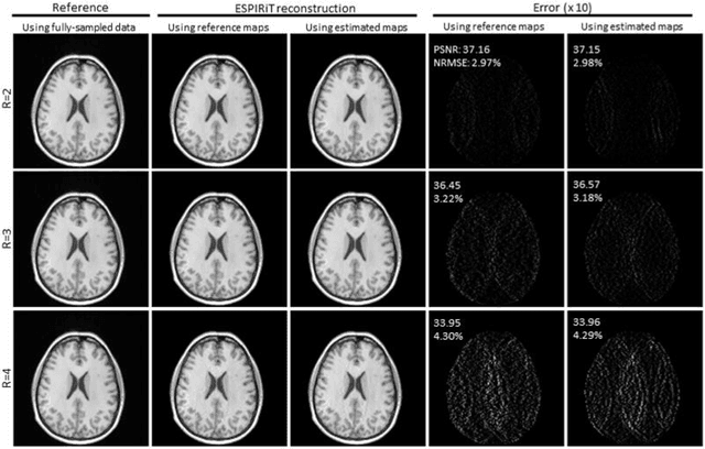 Figure 3 for Calibrationless Reconstruction of Uniformly-Undersampled Multi-Channel MR Data with Deep Learning Estimated ESPIRiT Maps