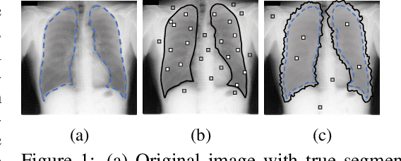 Figure 1 for Learning to Segment from Noisy Annotations: A Spatial Correction Approach