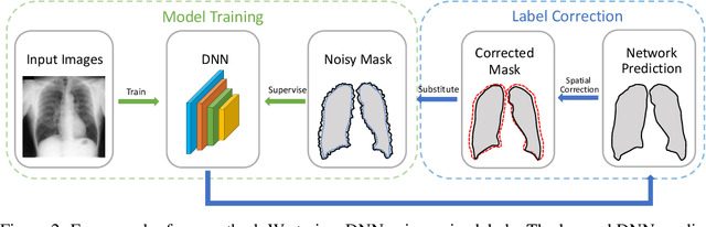 Figure 2 for Learning to Segment from Noisy Annotations: A Spatial Correction Approach