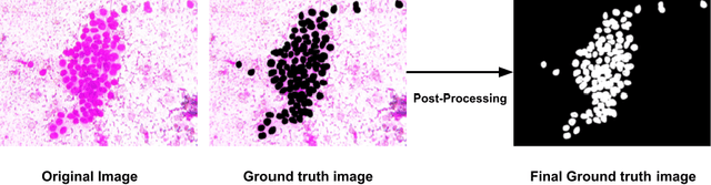 Figure 1 for Fuzzy Rank-based Late Fusion Technique for Cytology image Segmentation