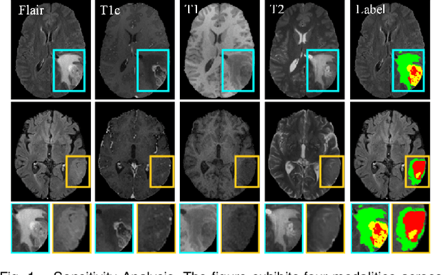 Figure 1 for Prototype-Driven and Multi-Expert Integrated Multi-Modal MR Brain Tumor Image Segmentation