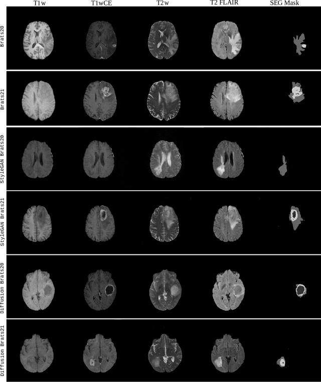 Figure 2 for Beware of diffusion models for synthesizing medical images -- A comparison with GANs in terms of memorizing brain tumor images