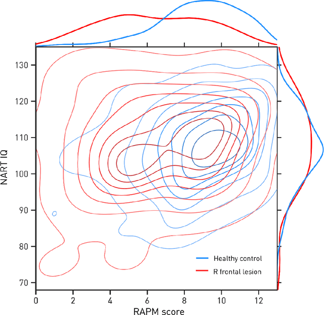 Figure 1 for The minimal computational substrate of fluid intelligence