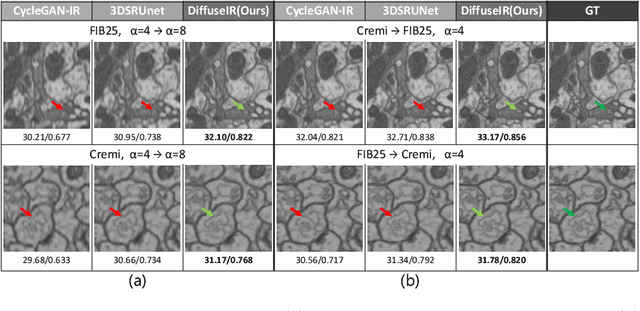 Figure 4 for DiffuseIR:Diffusion Models For Isotropic Reconstruction of 3D Microscopic Images