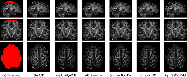 Figure 4 for TW-BAG: Tensor-wise Brain-aware Gate Network for Inpainting Disrupted Diffusion Tensor Imaging
