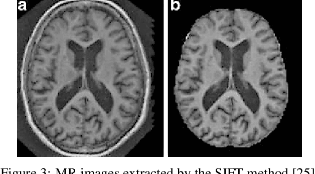 Figure 4 for Invariant Scattering Transform for Medical Imaging