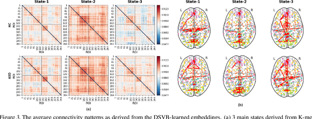 Figure 4 for A Deep Probabilistic Spatiotemporal Framework for Dynamic Graph Representation Learning with Application to Brain Disorder Identification