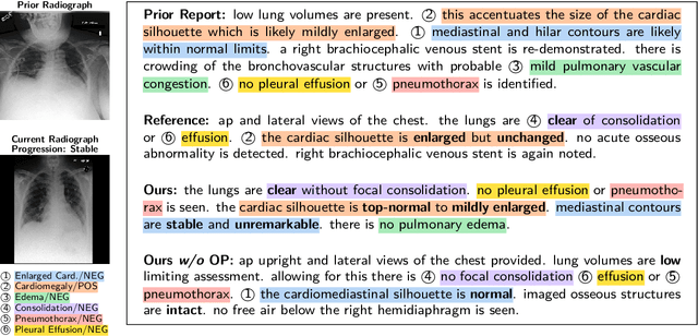 Figure 3 for RECAP: Towards Precise Radiology Report Generation via Dynamic Disease Progression Reasoning