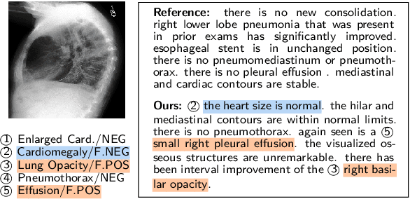 Figure 4 for RECAP: Towards Precise Radiology Report Generation via Dynamic Disease Progression Reasoning