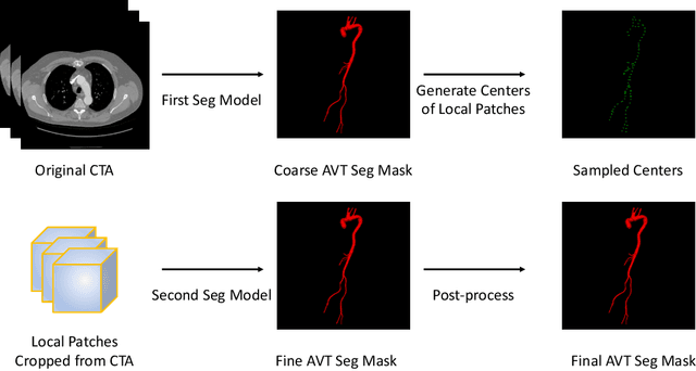 Figure 1 for Segmentation of Aortic Vessel Tree in CT Scans with Deep Fully Convolutional Networks