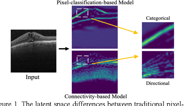 Figure 1 for Directional Connectivity-based Segmentation of Medical Images