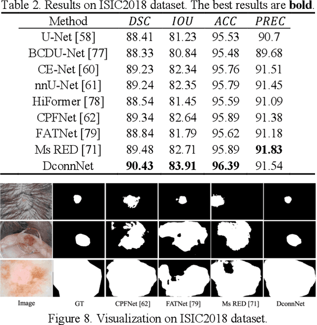 Figure 4 for Directional Connectivity-based Segmentation of Medical Images