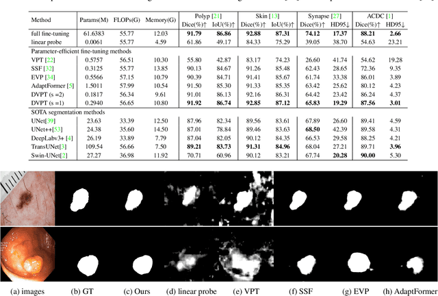 Figure 4 for DVPT: Dynamic Visual Prompt Tuning of Large Pre-trained Models for Medical Image Analysis