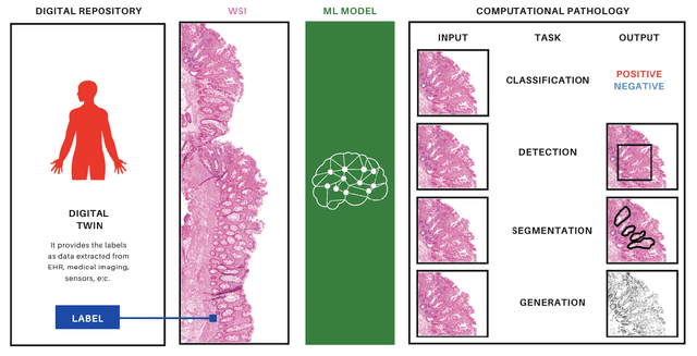 Figure 3 for A perspective on the use of health digital twins in computational pathology