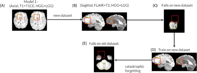 Figure 1 for Selective experience replay compression using coresets for lifelong deep reinforcement learning in medical imaging