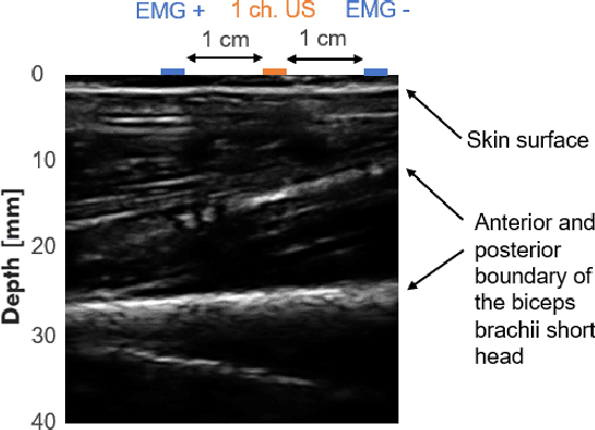 Figure 2 for A Wearable Ultra-Low-Power sEMG-Triggered Ultrasound System for Long-Term Muscle Activity Monitoring