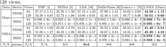 Figure 2 for Learned Alternating Minimization Algorithm for Dual-domain Sparse-View CT Reconstruction