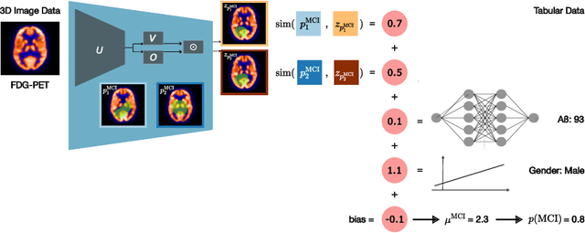 Figure 1 for Don't PANIC: Prototypical Additive Neural Network for Interpretable Classification of Alzheimer's Disease